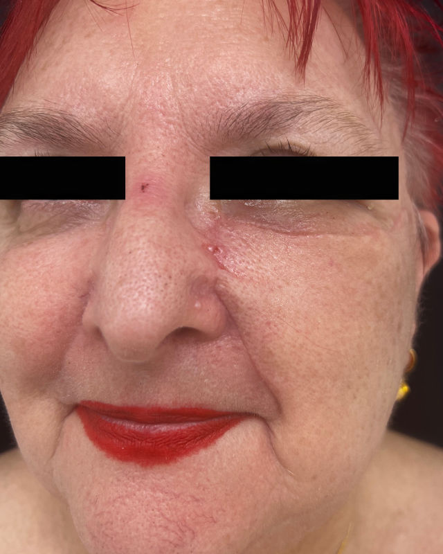 Reconstruction Treatments with Dr. Charles Bain in Dubai