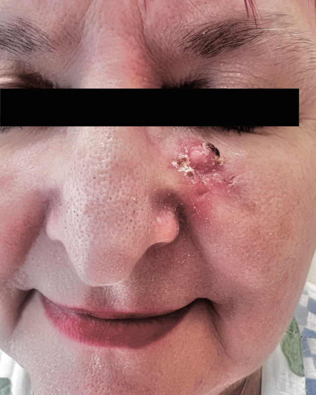 Reconstruction Treatments with Dr. Charles Bain